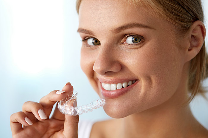 Clear Aligners