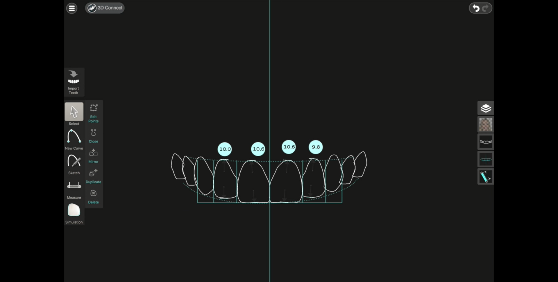 Digital Smile Design